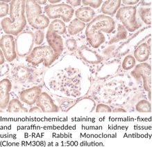 B-RAF Rabbit Monoclonal Antibody (Clone RM308)