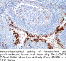 PD-L1/CD274 (C-Term) Rabbit Monoclonal Antibody (Clone RM320)