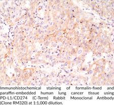 PD-L1/CD274 (C-Term) Rabbit Monoclonal Antibody (Clone RM320)