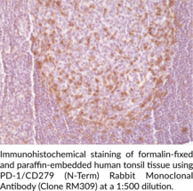 PD-1/CD279 (N-Term) Rabbit Monoclonal Antibody (Clone RM309)