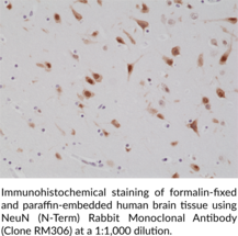 NeuN (N-Term) Rabbit Monoclonal Antibody (Clone RM306)