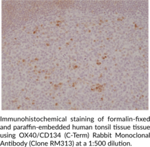 OX40/CD134 (C-Term) Rabbit Monoclonal Antibody (Clone RM313)