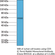 CD5 (C-Term) Rabbit Monoclonal Antibody (Clone RM314) (Cluster of Differentiation 5, Leu-1, Ly-1 Antigen, Lyt-1)