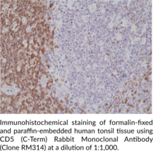 CD5 (C-Term) Rabbit Monoclonal Antibody (Clone RM314)