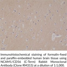 NCAM1/CD56 (C-Term) Rabbit Monoclonal Antibody (Clone RM315)