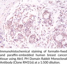 Akt1 PH Domain Rabbit Monoclonal Antibody (Clone RM316)