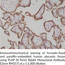 PLAP (N-Term) Rabbit Monoclonal Antibody (Clone RM317)