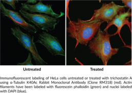 α-Tubulin K40Ac Rabbit Monoclonal Antibody (Clone RM318)