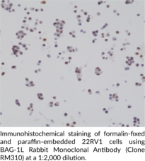 BAG-1L Rabbit Monoclonal Antibody (Clone RM310)