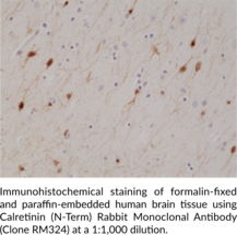 Calretinin (N-Term) Rabbit Monoclonal Antibody (Clone RM324)