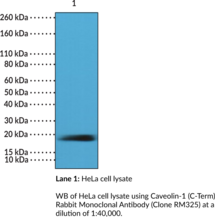 Caveolin-1 (C-Term) Rabbit Monoclonal Antibody (Clone RM325) (CAV-1)