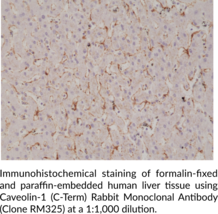Caveolin-1 (C-Term) Rabbit Monoclonal Antibody (Clone RM325)
