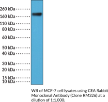 CEA Rabbit Monoclonal Antibody (Clone RM326)