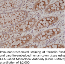 CEA Rabbit Monoclonal Antibody (Clone RM326)