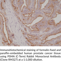 PSMA (C-Term) Rabbit Monoclonal Antibody (Clone RM327)