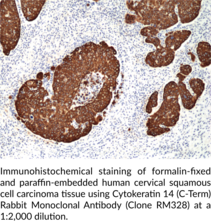 Cytokeratin 14 (C-Term) Rabbit Monoclonal Antibody (Clone RM328)