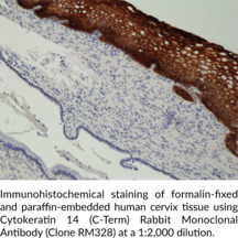 Cytokeratin 14 (C-Term) Rabbit Monoclonal Antibody (Clone RM328)