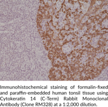 Cytokeratin 14 (C-Term) Rabbit Monoclonal Antibody (Clone RM328)