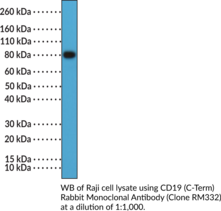 CD19 (C-Term) Rabbit Monoclonal Antibody (Clone RM332) (Cluster of Differentiation 19)