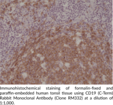 CD19 (C-Term) Rabbit Monoclonal Antibody (Clone RM332)