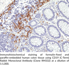 CD19 (C-Term) Rabbit Monoclonal Antibody (Clone RM332)
