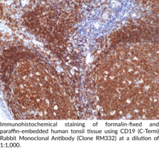 CD19 (C-Term) Rabbit Monoclonal Antibody (Clone RM332)