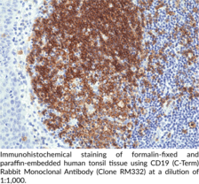 CD19 (C-Term) Rabbit Monoclonal Antibody (Clone RM332)