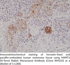 MART1 (N-Term) Rabbit Monoclonal Antibody (Clone RM333)