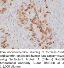 Surfactant Protein A (C-Term) Rabbit Monoclonal Antibody (Clone RM334)