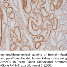 AMACR (N-Term) Rabbit Monoclonal Antibody (Clone RM349)