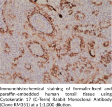 Cytokeratin 17 (C-Term) Rabbit Monoclonal Antibody (Clone RM351)