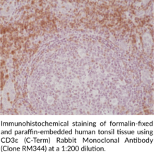 CD3ε (C-Term) Rabbit Monoclonal Antibody (Clone RM344)