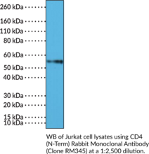 CD4 (N-Term) Rabbit Monoclonal Antibody (Clone RM345) (Cluster of Differentiation 4, T Cell Surface Antigen T4, T Cell Surface Glycoprotein CD4)