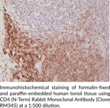 CD4 (N-Term) Rabbit Monoclonal Antibody (Clone RM345)