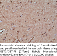GST3/GST-Pi (C-Term) Rabbit Monoclonal Antibody (Clone RM347)