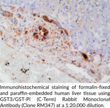 GST3/GST-Pi (C-Term) Rabbit Monoclonal Antibody (Clone RM347)