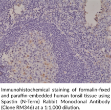Spastin (N-Term) Rabbit Monoclonal Antibody (Clone RM346)
