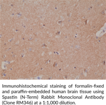 Spastin (N-Term) Rabbit Monoclonal Antibody (Clone RM346)
