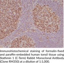 Stathmin 1 (C-Term) Rabbit Monoclonal Antibody (Clone RM350)