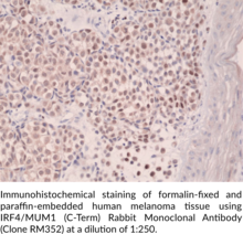 IRF4/MUM1 (C-Term) Rabbit Monoclonal Antibody (Clone RM352)