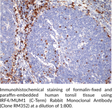 IRF4/MUM1 (C-Term) Rabbit Monoclonal Antibody (Clone RM352)