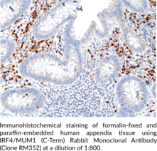 IRF4/MUM1 (C-Term) Rabbit Monoclonal Antibody (Clone RM352)