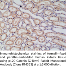 p120-Catenin (C-Term) Rabbit Monoclonal Antibody (Clone RM353)