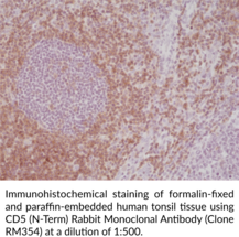 CD5 (N-Term) Rabbit Monoclonal Antibody (Clone RM354)