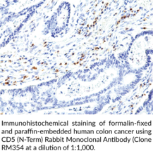 CD5 (N-Term) Rabbit Monoclonal Antibody (Clone RM354)