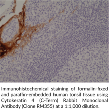 Cytokeratin 4 (C-Term) Rabbit Monoclonal Antibody (Clone RM355)