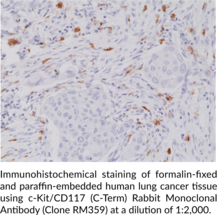 c-Kit/CD117 (C-Term) Rabbit Monoclonal Antibody (Clone RM359)