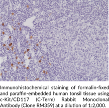 c-Kit/CD117 (C-Term) Rabbit Monoclonal Antibody (Clone RM359)