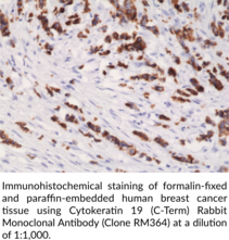 Cytokeratin 19 (C-Term) Rabbit Monoclonal Antibody (Clone RM364)