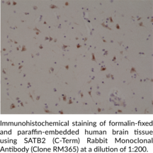 SATB2 (C-Term) Rabbit Monoclonal Antibody (Clone RM365)